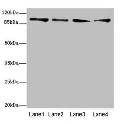 Invitrogen TNNI3K Polyclonal Antibody 100 &mu;L; Unconjugated:Antibodies,