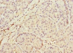 Invitrogen MEST Polyclonal Antibody 100 &mu;L; Unconjugated:Antibodies,
