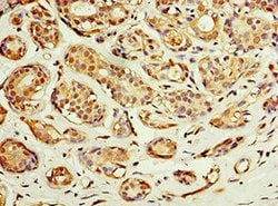 Invitrogen ACSM3 Polyclonal Antibody 100 &mu;L; Unconjugated:Antibodies,