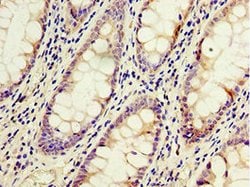 Invitrogen ACSM3 Polyclonal Antibody 100 &mu;L; Unconjugated:Antibodies,