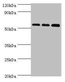 Invitrogen ACSM3 Polyclonal Antibody 100 &mu;L; Unconjugated:Antibodies,