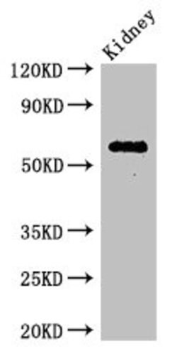 Invitrogen C6orf10 Polyclonal Antibody 100 &mu;g; Unconjugated:Antibodies,