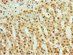 Invitrogen ATAD3B Polyclonal Antibody 100 &mu;L; Unconjugated:Antibodies,