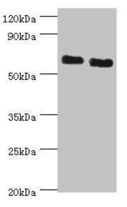 Invitrogen ATAD3B Polyclonal Antibody 100 &mu;L; Unconjugated:Antibodies,