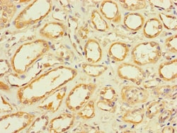 GLT8D1 Polyclonal Antibody:Antibodies, Polyclonal