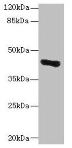 GLT8D1 Polyclonal Antibody:Antibodies, Polyclonal