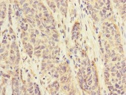 Invitrogen FCRL6 Polyclonal Antibody 100 μL; Unconjugated:Antibodies,