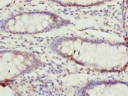 Invitrogen TTC38 Polyclonal Antibody 100 &mu;g | Buy Online | Invitrogen&trade; | Fisher Scientific