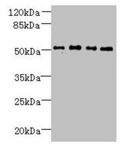 Invitrogen TTC38 Polyclonal Antibody 100 &mu;g | Buy Online | Invitrogen&trade; | Fisher Scientific