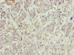Invitrogen C1orf101 Polyclonal Antibody 100 &mu;g; Unconjugated:Antibodies,