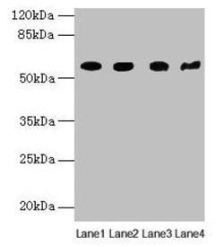 Invitrogen KRT79 Polyclonal Antibody 100 &mu;g; Unconjugated:Antibodies,