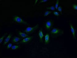 Invitrogen PVRIG Polyclonal Antibody 100 &mu;g; Unconjugated:Antibodies,