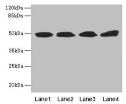 Invitrogen TBCEL Polyclonal Antibody 100 &mu;g; Unconjugated:Antibodies,