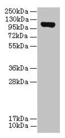 DENND2C Polyclonal Antibody:Antibodies, Polyclonal