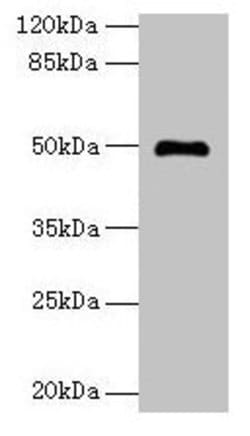 Invitrogen ADAL Polyclonal Antibody 100 μg; Unconjugated:Antibodies,