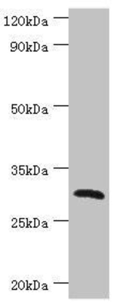 Invitrogen CLEC12A Polyclonal Antibody 100 &mu;L; Unconjugated:Antibodies,
