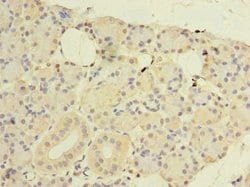 Invitrogen CWF19L1 Polyclonal Antibody 100 &mu;g; Unconjugated:Antibodies,