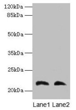 Invitrogen LGALS9C Polyclonal Antibody 100 &mu;g; Unconjugated:Antibodies,
