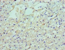 Invitrogen LDLRAP1 Polyclonal Antibody 100 &mu;L; Unconjugated:Antibodies,