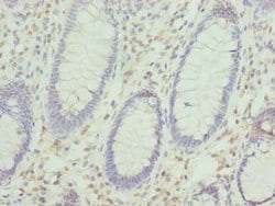 Invitrogen KHDRBS2 Polyclonal Antibody 100 &mu;g; Unconjugated:Antibodies,