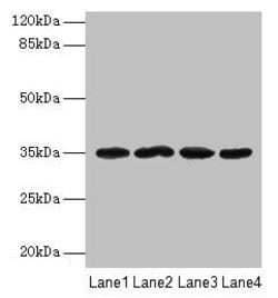 Invitrogen METRNL Polyclonal Antibody 100 &mu;g; Unconjugated:Antibodies,