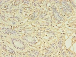 Invitrogen CCP2 Polyclonal Antibody 100 &mu;g; Unconjugated:Antibodies,