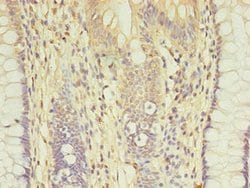 Invitrogen CCP2 Polyclonal Antibody 100 &mu;g; Unconjugated:Antibodies,
