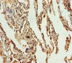 Invitrogen SLC34A1 Polyclonal Antibody 100 &mu;L; Unconjugated:Antibodies,