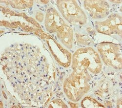 Invitrogen SLC34A1 Polyclonal Antibody 100 &mu;L; Unconjugated:Antibodies,