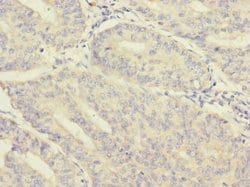 Invitrogen Morn5 Polyclonal Antibody 100 μg; Unconjugated:Antibodies,