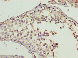 Invitrogen CYB5R2 Polyclonal Antibody 100 &mu;g; Unconjugated:Antibodies,
