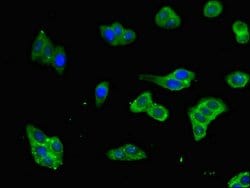 Invitrogen FAM151B Polyclonal Antibody 100 μg; Unconjugated:Antibodies,