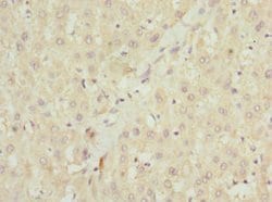 Invitrogen NHLRC1 Polyclonal Antibody 100 &mu;L; Unconjugated:Antibodies,