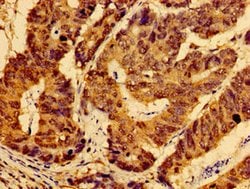 Invitrogen AHSA2 Polyclonal Antibody 100 &mu;g | Buy Online | Invitrogen&trade; | Fisher Scientific