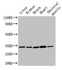 Invitrogen AHSA2 Polyclonal Antibody 100 &mu;g | Buy Online | Invitrogen&trade; | Fisher Scientific