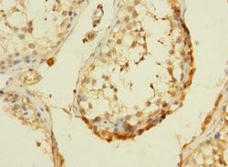 Invitrogen DHX32 Polyclonal Antibody 100 &mu;g; Unconjugated:Antibodies,