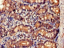 Invitrogen IL-34 Polyclonal Antibody 100 &mu;g | Buy Online | Invitrogen&trade; | Fisher Scientific