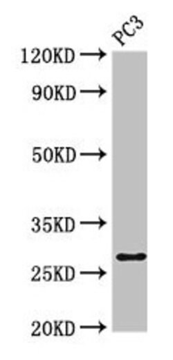 Invitrogen IL-34 Polyclonal Antibody 100 &mu;g | Buy Online | Invitrogen&trade; | Fisher Scientific