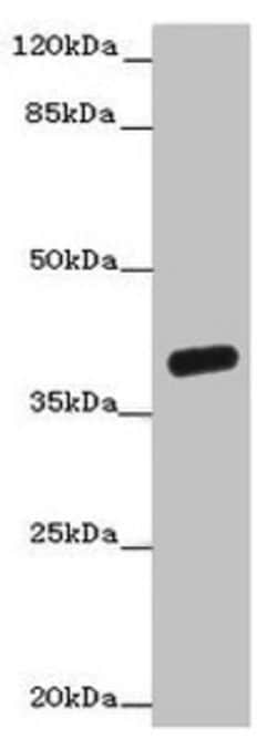 Invitrogen OGFOD2 Polyclonal Antibody 100 &mu;g; Unconjugated:Antibodies,