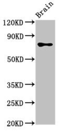 Invitrogen CASC1 Polyclonal Antibody 100 &mu;g; Unconjugated:Antibodies,