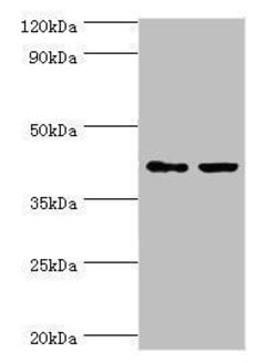 Invitrogen GTF2H2C Polyclonal Antibody 100 &mu;L; Unconjugated:Antibodies,