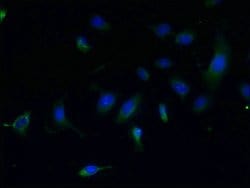 Invitrogen CCDC108 Polyclonal Antibody 100 &mu;g; Unconjugated:Antibodies,