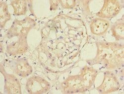 Invitrogen CCDC108 Polyclonal Antibody 100 &mu;g; Unconjugated:Antibodies,