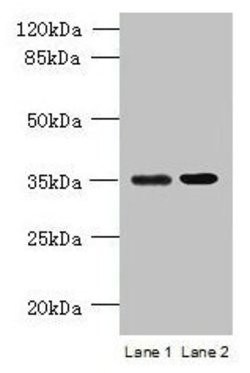 Invitrogen CCDC108 Polyclonal Antibody 100 &mu;g; Unconjugated:Antibodies,