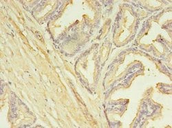 Invitrogen SLC25A25 Polyclonal Antibody 100 μg; Unconjugated:Antibodies,