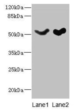 Invitrogen SLC25A25 Polyclonal Antibody 100 μg; Unconjugated:Antibodies,