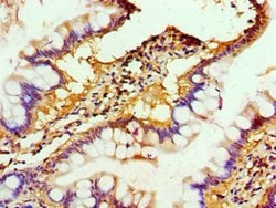 Invitrogen ALKBH2 Polyclonal Antibody 100 &mu;L; Unconjugated:Antibodies,