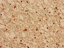 Invitrogen FGD6 Polyclonal Antibody 100 &mu;g | Buy Online | Invitrogen&trade; | Fisher Scientific