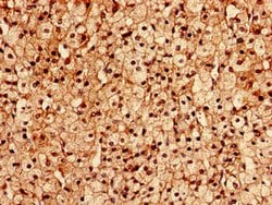Invitrogen FGD6 Polyclonal Antibody 100 &mu;g | Buy Online | Invitrogen&trade; | Fisher Scientific