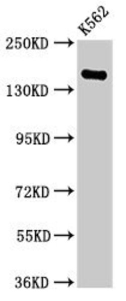 Invitrogen FGD6 Polyclonal Antibody 100 &mu;g | Buy Online | Invitrogen&trade; | Fisher Scientific